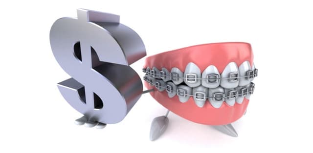 Chi phí niềng răng hô tại nha khoa có cao không?