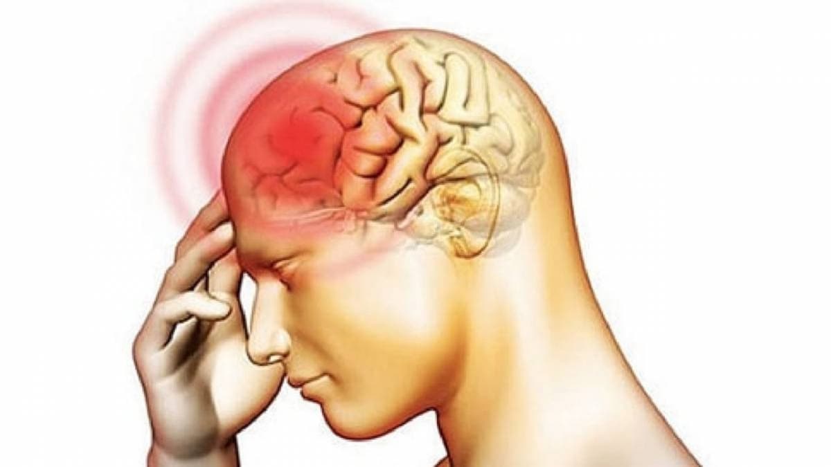 Dấu hiệu u não lành tính – cách điều trị