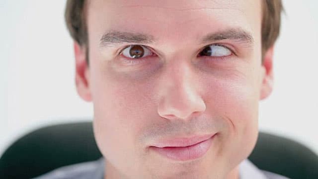 mắt lé là hậu quả của 2 mắt tật khúc xạ không đều gây ra