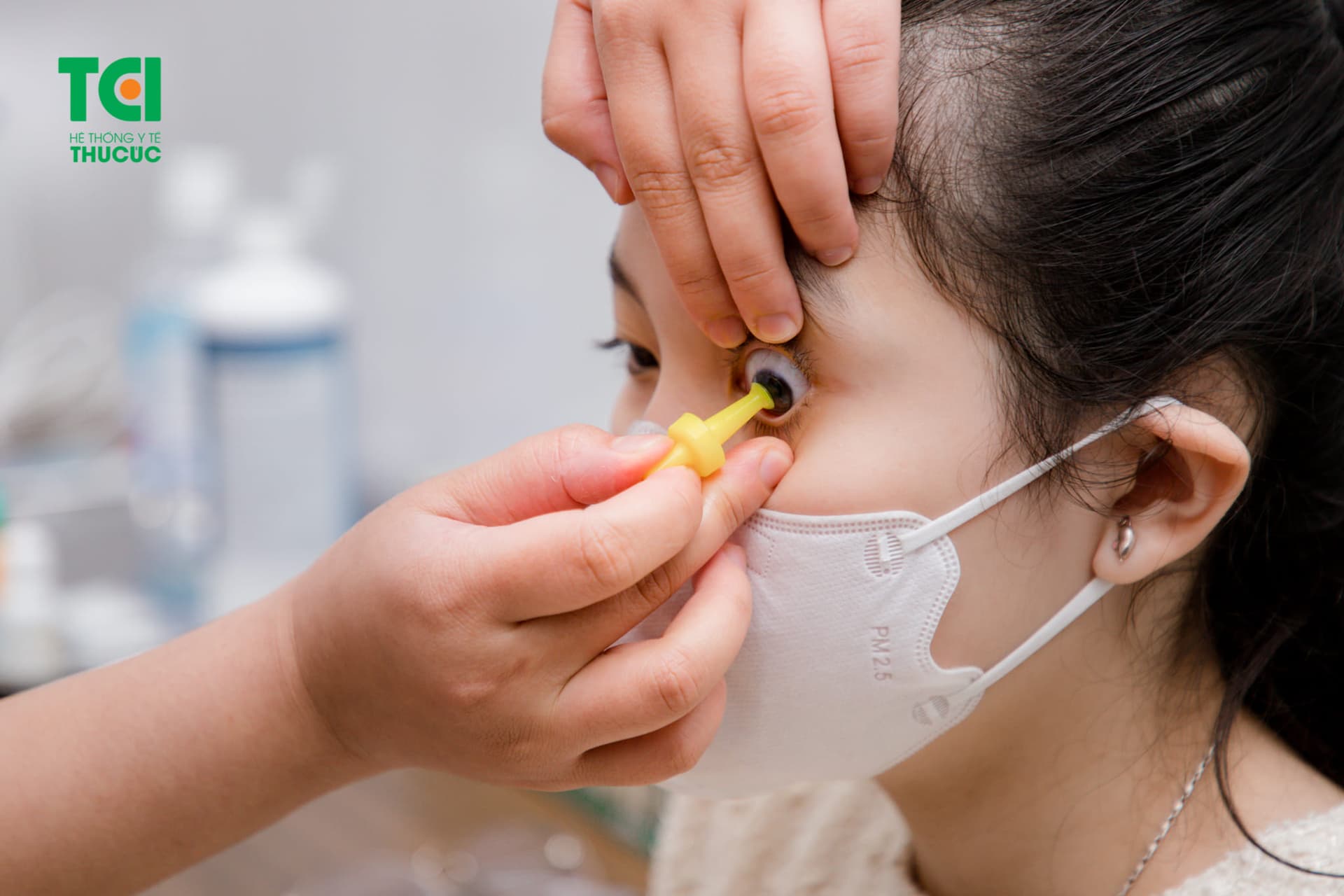 Điều trị mắt bị tật khúc xạ bằng kính Ortho K