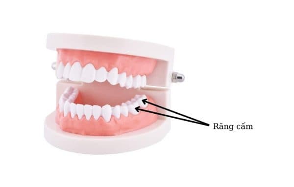 Răng cấm (răng cối lớn: mọc ở vị trí số 6 và số 7 trên cung hàm