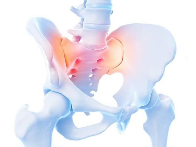 biến chứng của viêm khớp xương chậu