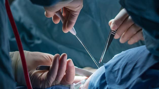 Cách chữa ung thư vú