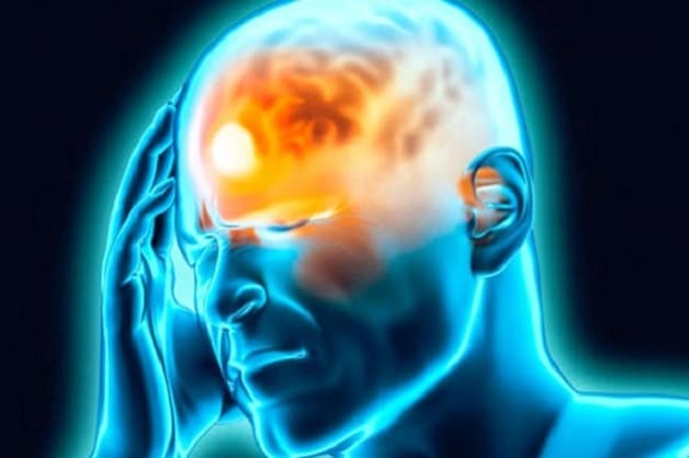 chụp MRI não là gì 