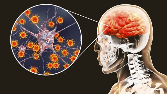 Đau đầu mạn tính là bệnh gì? Có nguy hiểm không?