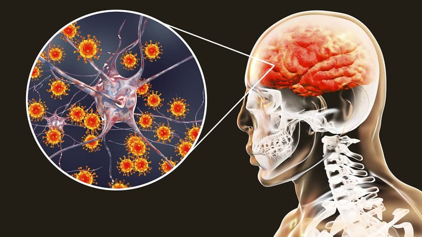 Đau đầu mạn tính là bệnh gì? Có nguy hiểm không?