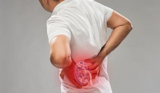 triệu chứng bệnh sỏi tiết niệu