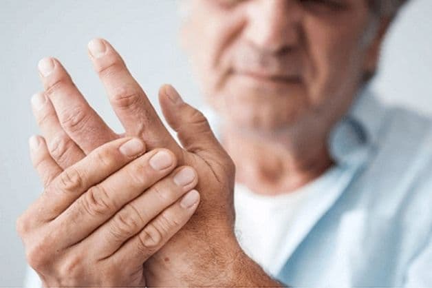 Triệu chứng sưng, đỏ, nóng khi bị viêm khớp dạng thấp 