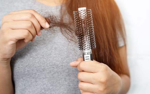 Mất ngủ rụng tóc: Tại sao lại trở thành nỗi ám ảnh?