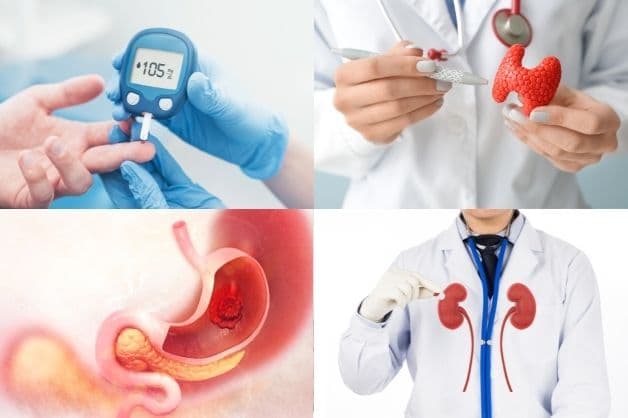 Mất ngủ sụt cân là bệnh gì?