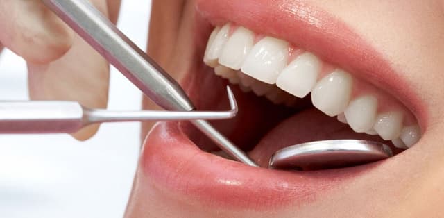 Tìm hiểu về phẫu thuật nạo túi lợi tại nha khoa