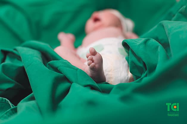 Mẹ bị tắc tia sữa sẽ khiến bé bị khát sữa mẹ, đề kháng yếu, phát triển kém