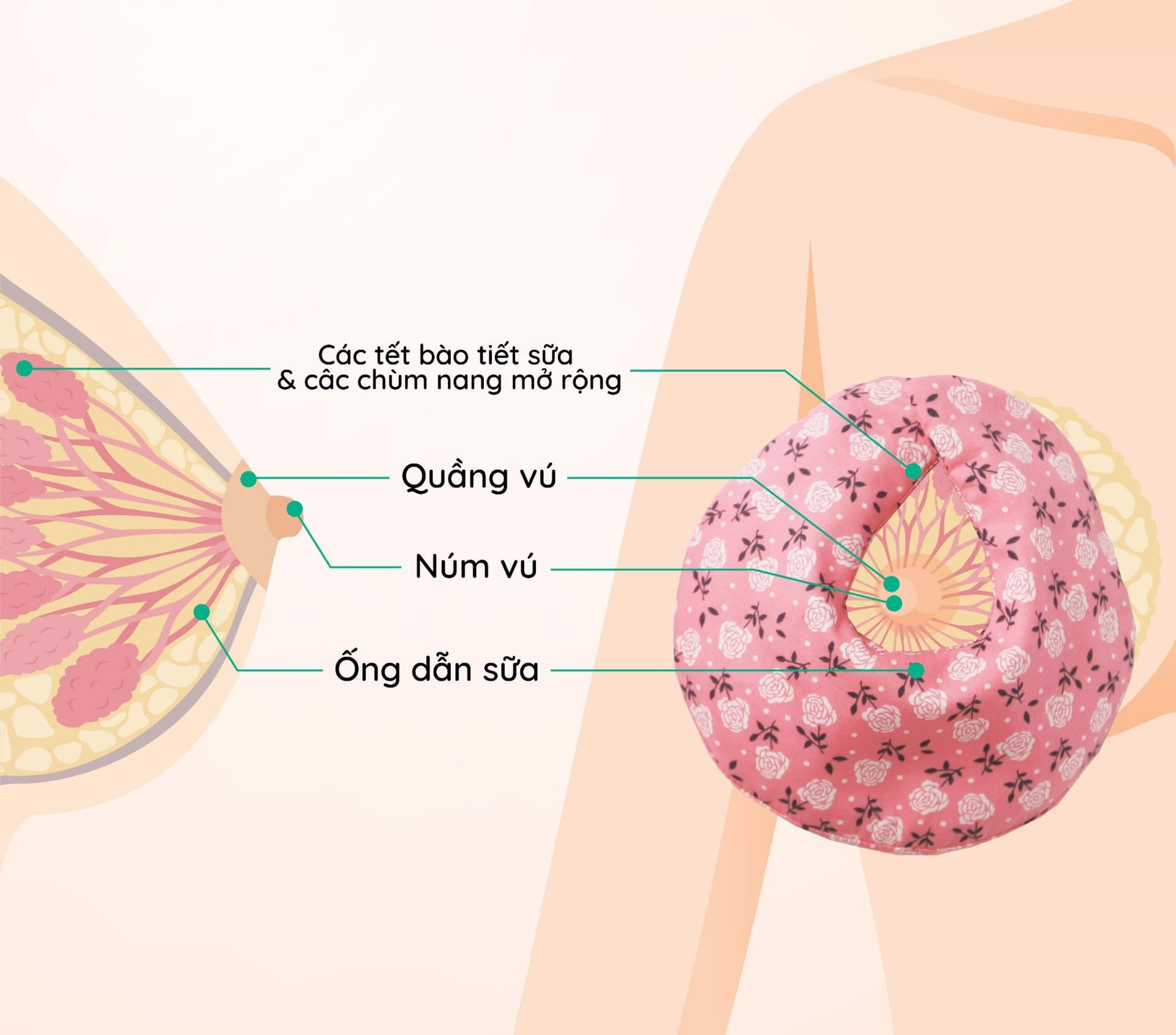 Tắc tia sữa là tình trạng sữa bị ứ đọng trong ống dẫn sữa không thoát ra ngoài được, do ống dẫn sữa hẹp hoặc bị bịt kín