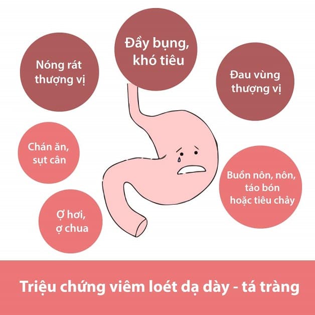 Các triệu chứng viêm dạ dày gây ra không ít phiền toái cho người bệnh
