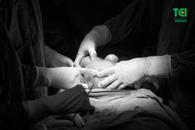 U xơ tử cung khi phát triển to sẽ có khả năng gây chèn ép tới các bộ phận khác