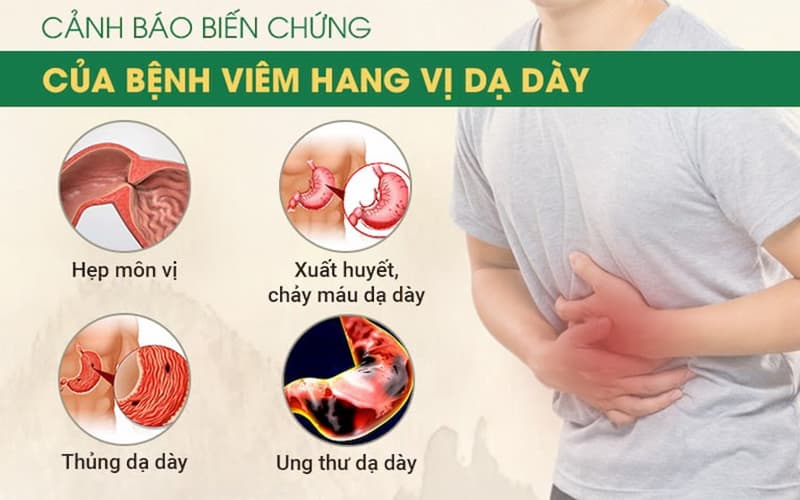 Viêm hang vị nếu không được chữa trị sớm có thể dẫn tới ung thư