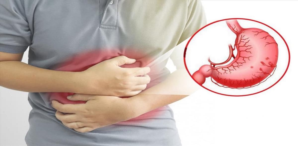 Viêm hang vị và tất cả những điều bạn cần biết