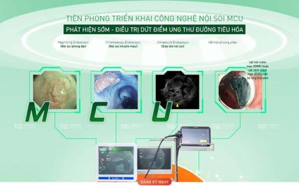 Nội soi MCU chẩn đoán ung thư đại tràng là gì?