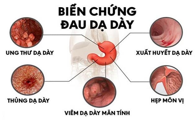 Bệnh có thể gây ra nhiều biến chứng nguy hiểm