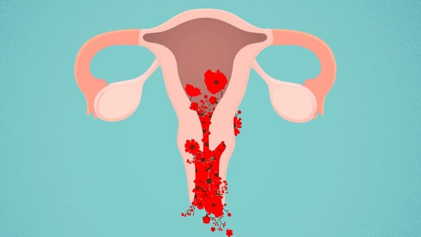 TOP cách trị rong kinh hiệu quả nhất chị em cần biết