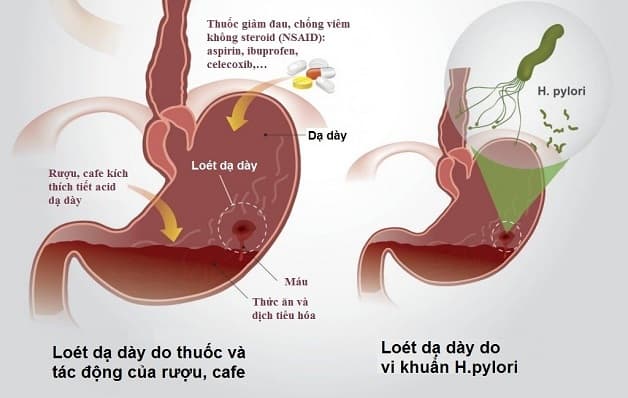 Bệnh có thể do nhiều nguyên nhân gây ra