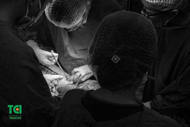 Bệnh nhân 36 tuổi thoát khỏi đa u xơ tử cung với phương pháp mổ mở