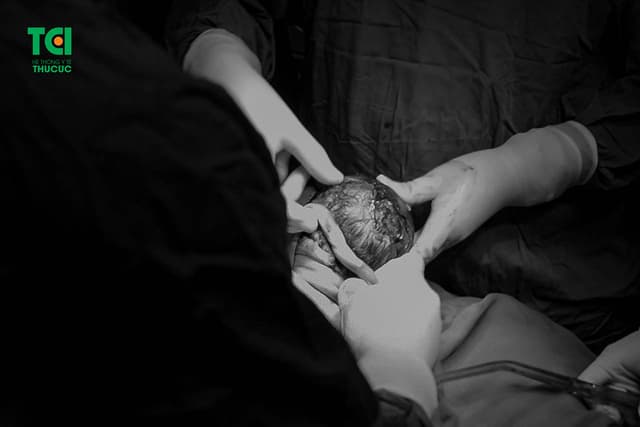 Ca vượt cạn ngoạn mục, đón bé chào đời an toàn với 4 vòng rau quấn cổ