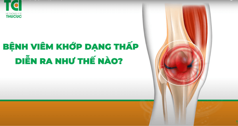 Viêm Khớp Dạng Thấp nguy hiểm, phát hiện và xử trí thế nào?