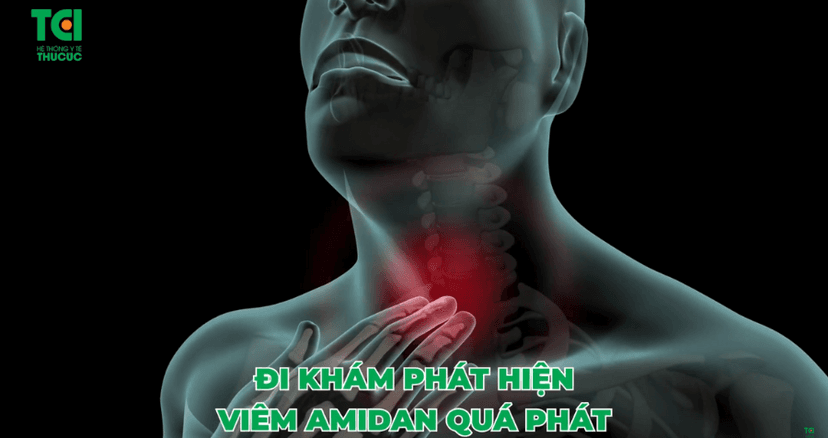 Viêm amidan quá phát có thể gây ra những hậu quả gì?