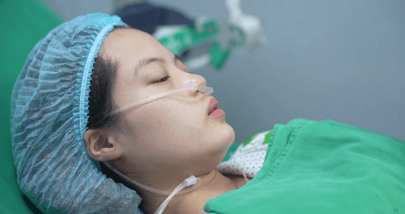 Chỉ khâu tầng sinh môn bao lâu thì tiêu?