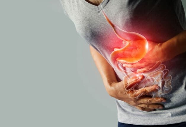 Cách chữa viêm loét dạ dày tại nhà chỉ nên áp dụng trong trường hợp bệnh nhẹ