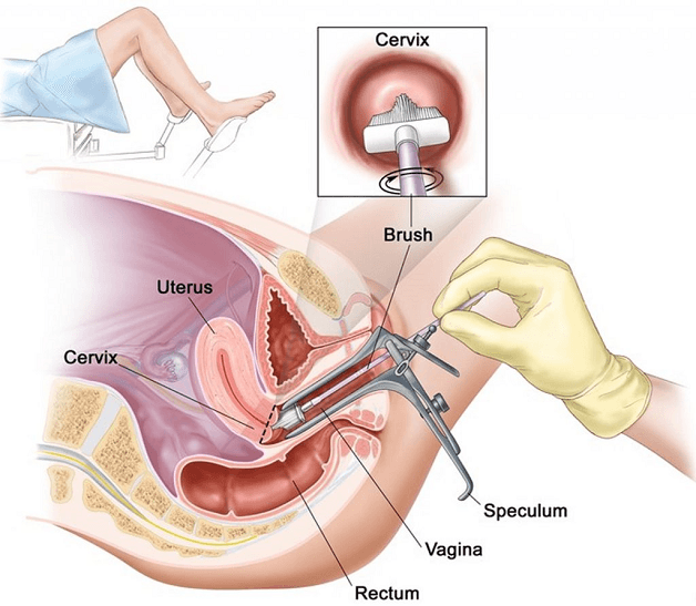 kết quả xét nghiệm pap smear
