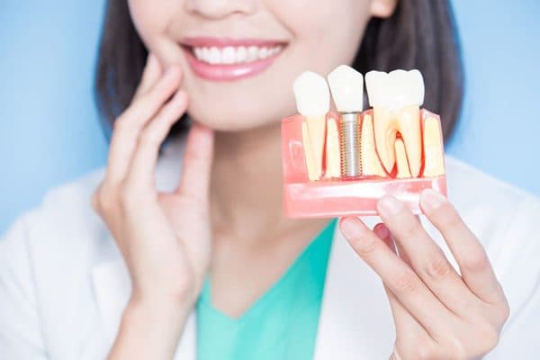 Phục hình sứ trên Implant là giải pháp được nhiều người tin tưởng lựa chọn bởi rất nhiều ưu điểm vượt trội