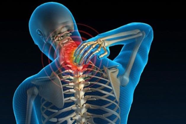 Bệnh thoái hóa cột sống cổ là gì?