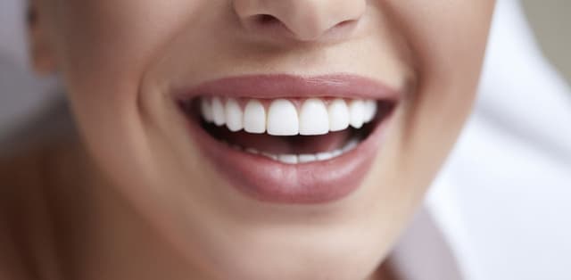 Ưu điểm của bọc răng sứ thẩm mỹ phục hình