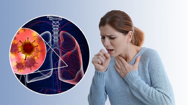 4 điều cần biết về tầm soát ung thư phổi