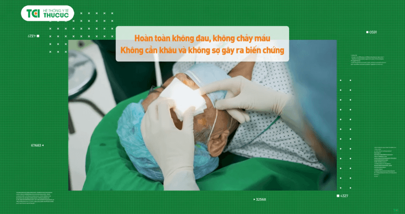 Phương pháp phẫu thuật Phaco mổ mắt hiệu quả