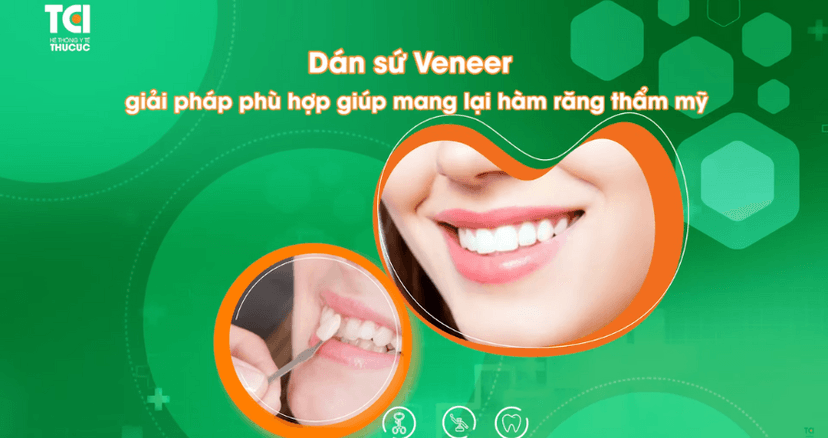 Dán sứ Veneer – Giải pháp vàng cho hàm răng khiếm khuyết nhẹ
