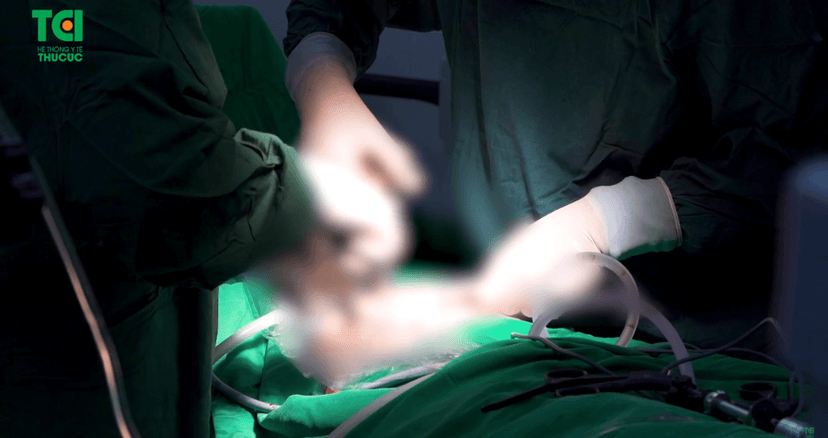 Phẫu thuật bóc u nang buồng trứng cho bệnh nhân 18 tuổi