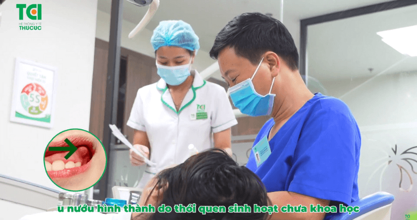 Giải quyết triệt để tình trạng u nướu chỉ trong tích tắc