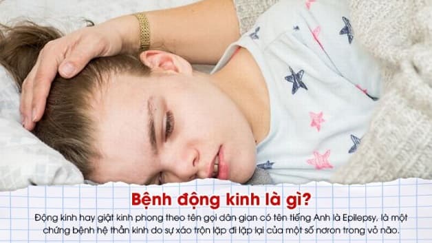 bệnh động kinh