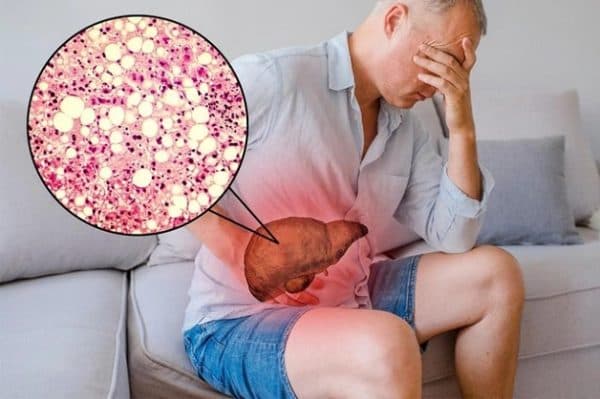 gan nhiễm mỡ nên ăn gì và bệnh gan nhiễm mỡ