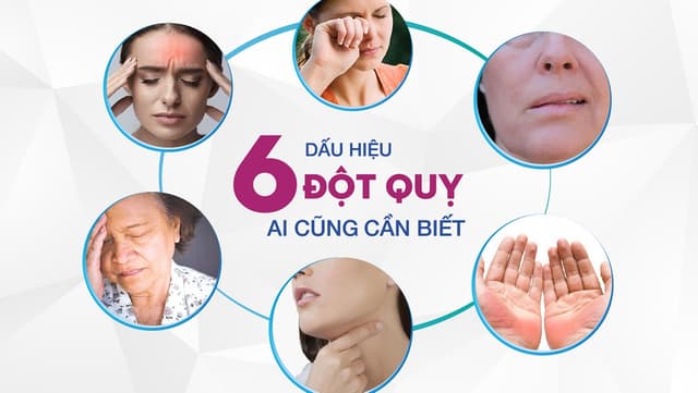 Bị tai biến mạch máu não có nguy hiểm? Dấu hiệu nhận diện