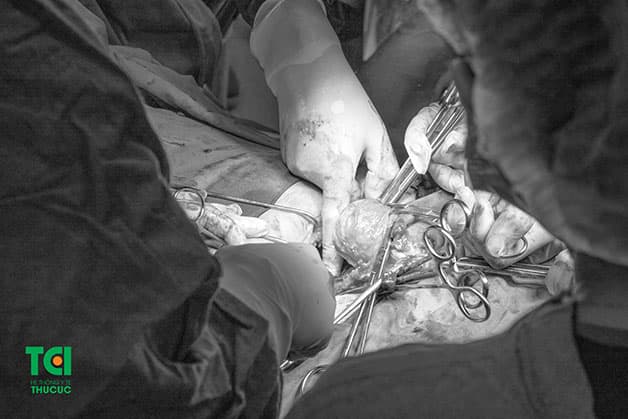 Ngay cả khi cắt bỏ hoàn toàn tử cung, chị em cũng không cần lo ngại về vấn đề quan hệ tình dục, giảm ham muốn sau phẫu thuật