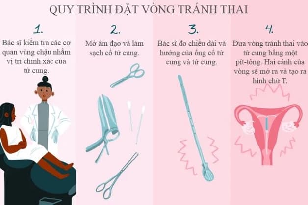 Trước khi sử dụng biện pháp ngừa thai này, chị em phụ nữ nên có sự tìm hiểu, thăm khám bác sĩ để có thể cân nhắc kĩ các ưu điểm, nhược điểm và thời gian có thể áp dụng đặt vòng tránh thai.