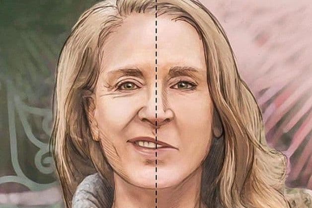 Cảnh báo dấu hiệu đột quỵ ở mặt