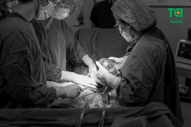 Đẻ mổ sau bao lâu được quan hệ - mẹ cần tránh gây áp lực lên vùng bụng