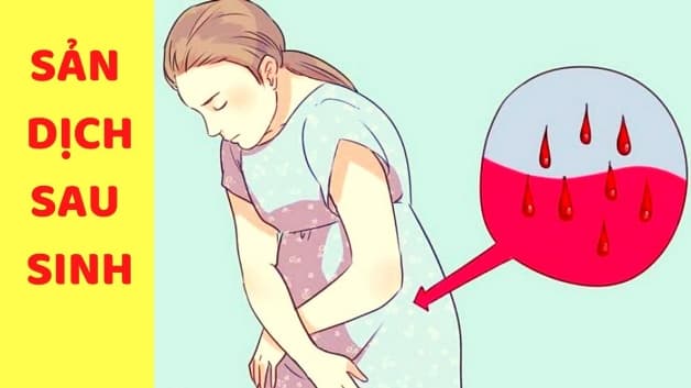 Đẻ thường bao giờ hết sản dịch - Sản dịch của mẹ sau sinh là dạng chất lỏng tiết ra từ phía âm đạo của người mẹ sau khi trải qua công cuộc sinh con