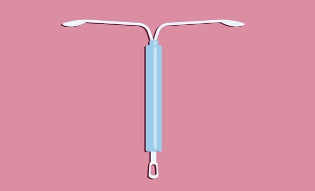 Giá tiền đặt vòng tránh thai tùy từng loại