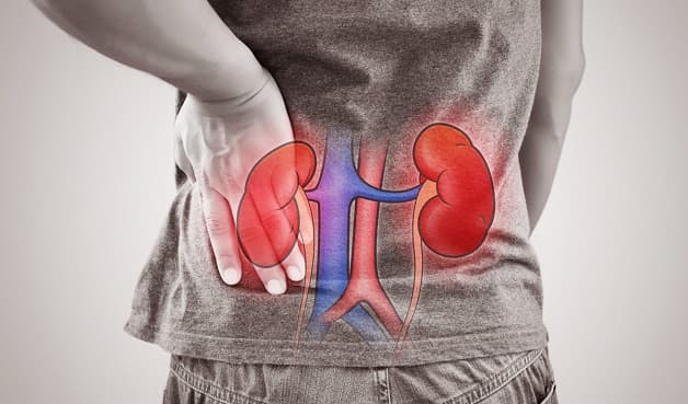 sỏi tiết niệu và cách điều trị hiệu quả khi có biến chứng